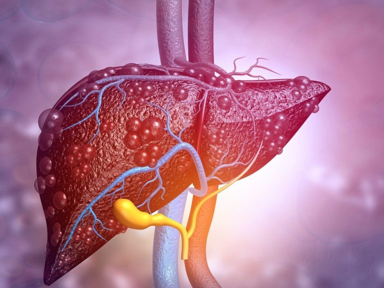 Hepatic encephalopathy – types, causes, symptoms and treatment