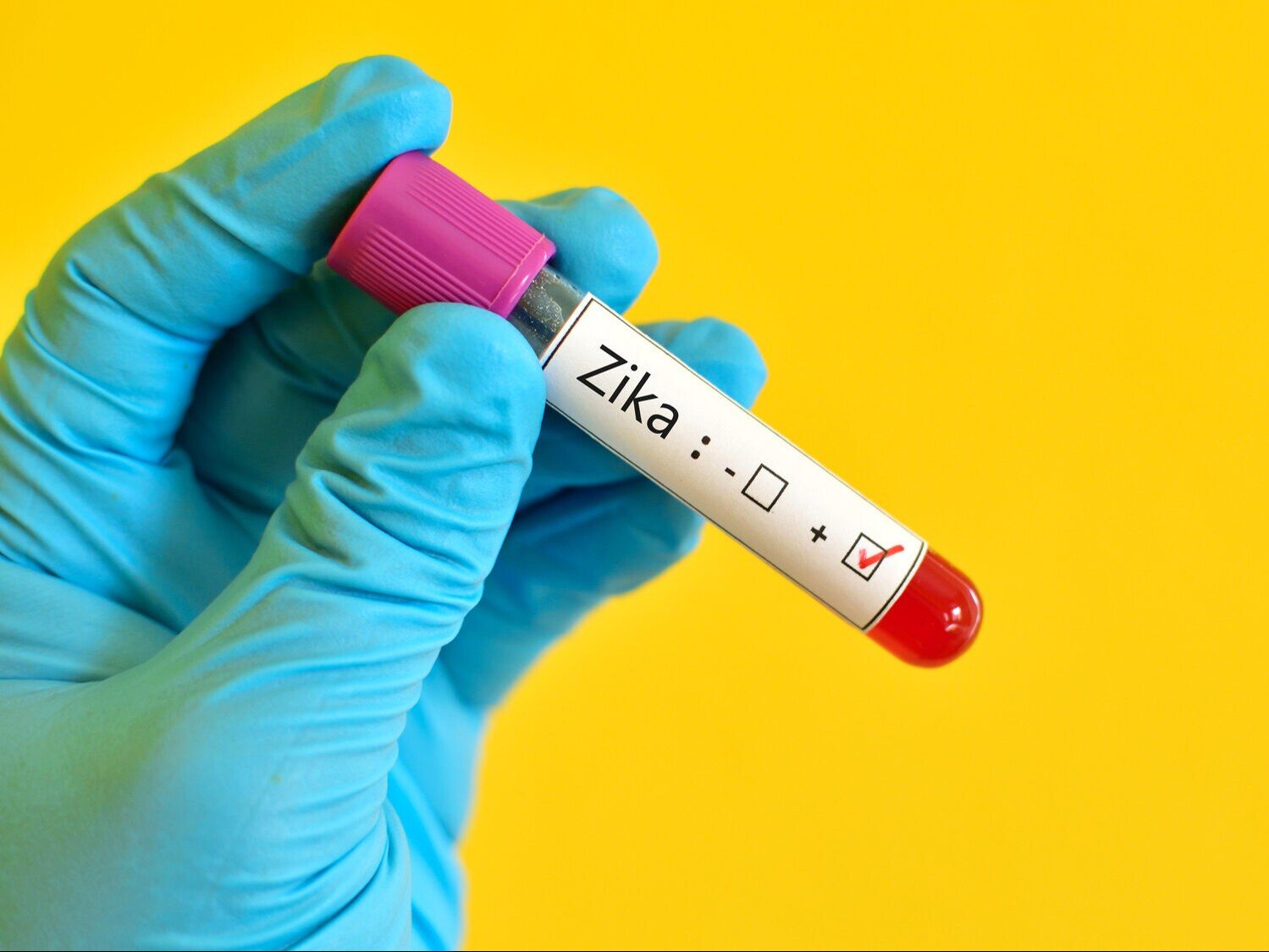 Prototype of a vaccine against the Zika virus.  Success of Polish scientists