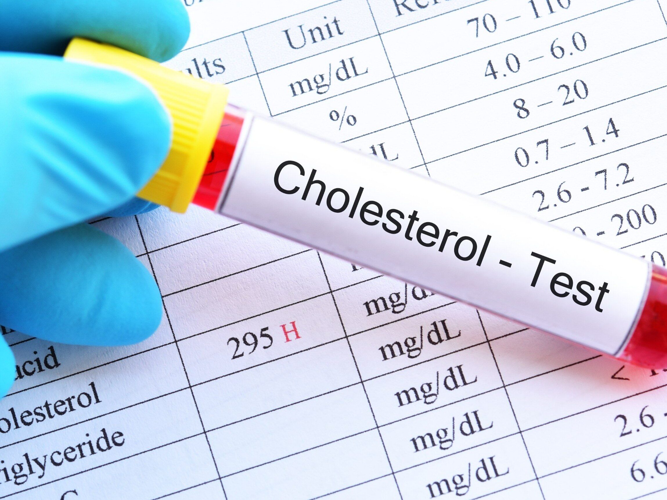 Can Good Cholesterol Contribute to Dementia?  The scientists' findings are surprising