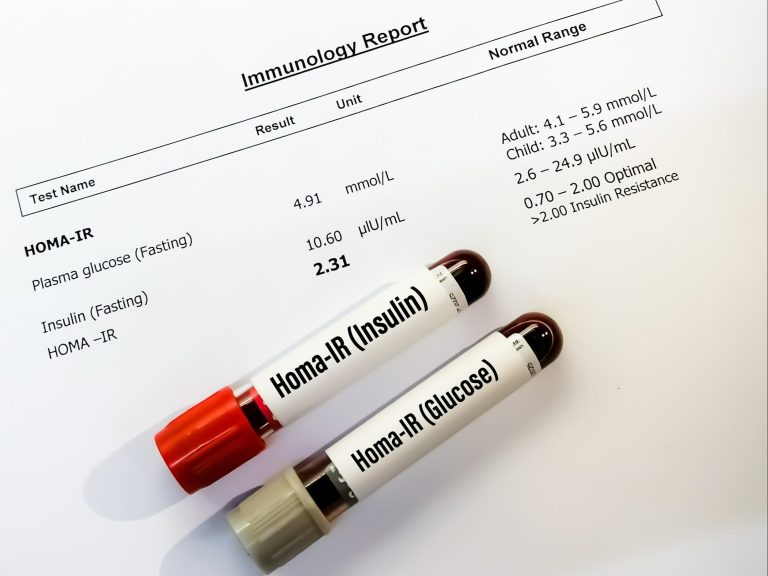 Do you suspect insulin resistance?  Check the HOMA indicator.  See what it is and how to calculate it